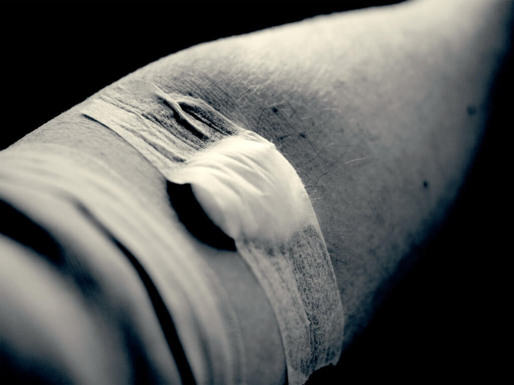 Man's arm with bandage and cotton ball covering location where blood was drawn.
