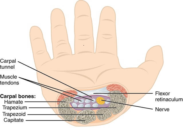 Schematic of the hand, labeling the carpal tunnel and its components, including the tendons, flexor retinaculum, and bones.