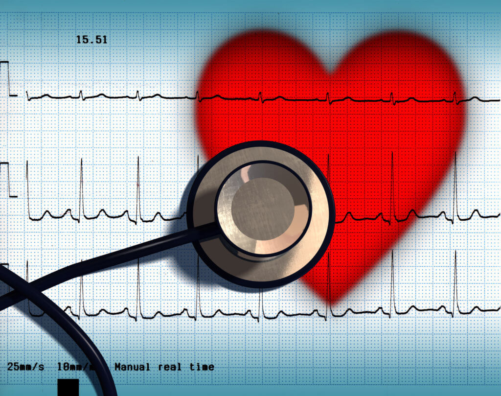 Graphic of an EKG with a heart and stethoscope superimposed over the EKG.